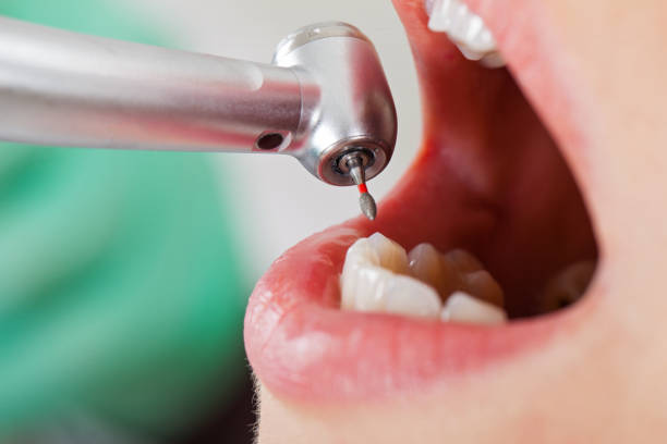 Best Emergency Broken Tooth Repair in Pis, AR